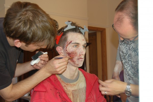 Prosthetic Application